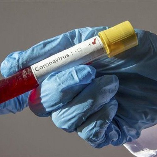 Azərbaycanda 38 yeni koronavirus infeksiyasına yoluxma faktı qeydə alınıb.