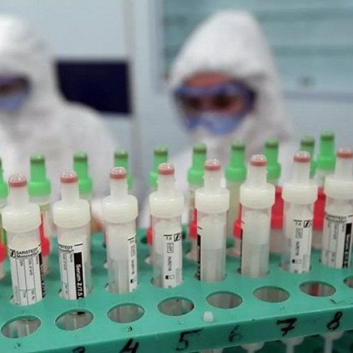 Oqtay Şirəliyev: “Koronavirusla bağlı yalnız paytaxtda deyil, regionlarda da test yoxlamaları aparılır”